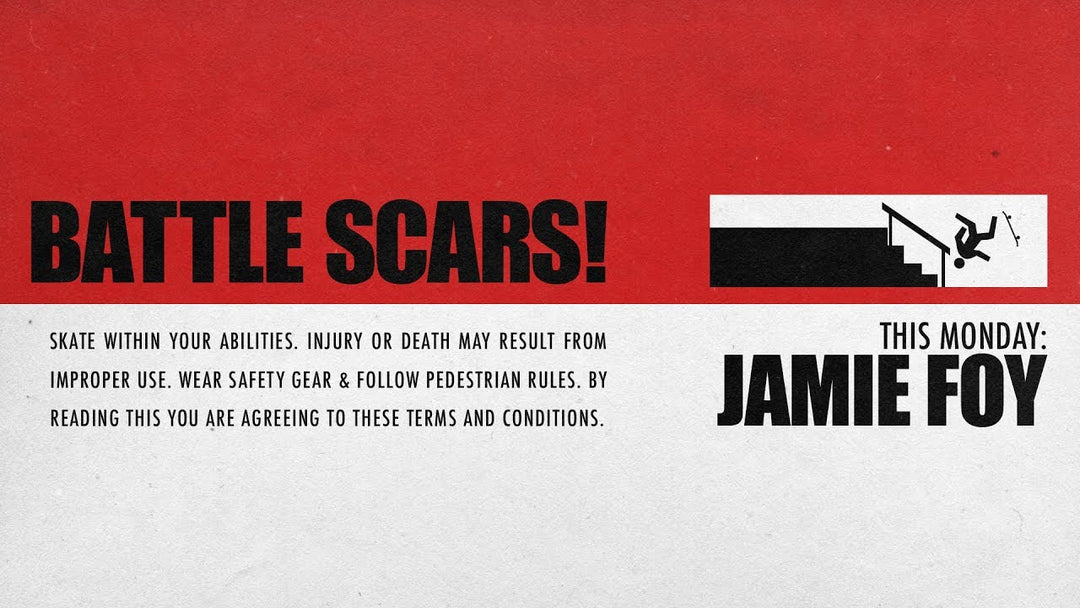 Jamie Foy's Battle Scars